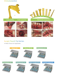 surgery x 2 surgery x 2 پیزوسرجری وودپیکر surgery x