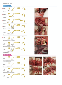 ultrasurgery5 ultrasurgery5 woodpecker ultra surgery